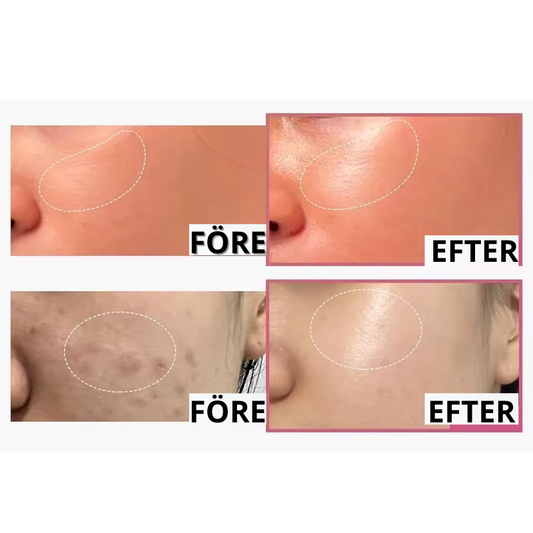 Korean Collagen Jelly Cream – Djup Återfuktning & Mjuk Hud